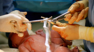 Childbirth, 2nd stage, cutting the cord